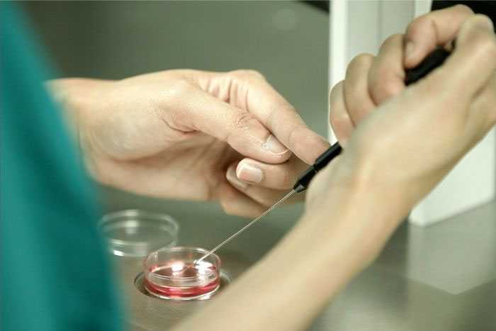 【做试管婴儿身体要求】助孕侠科普男女双方做试管婴儿身体要求